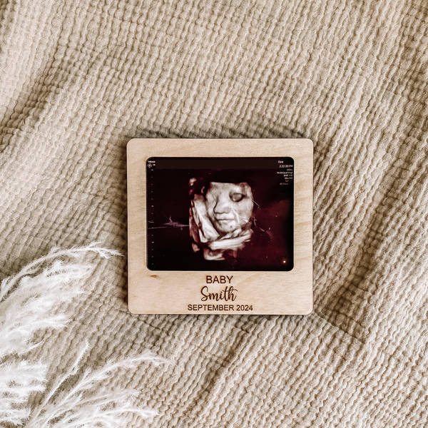 Ultrasound Wooden Magnets